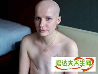 乳腺癌晚期能活多久