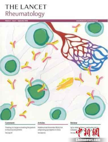 图为8月28日在英国伦敦正式发布的《柳叶刀·风湿病学》期刊封面。由清华大学临床医学院教授徐沪济牵头、针对国产生物类似药大型临床Ⅲ期研究成果刊登，并获封面推介。受访者供图