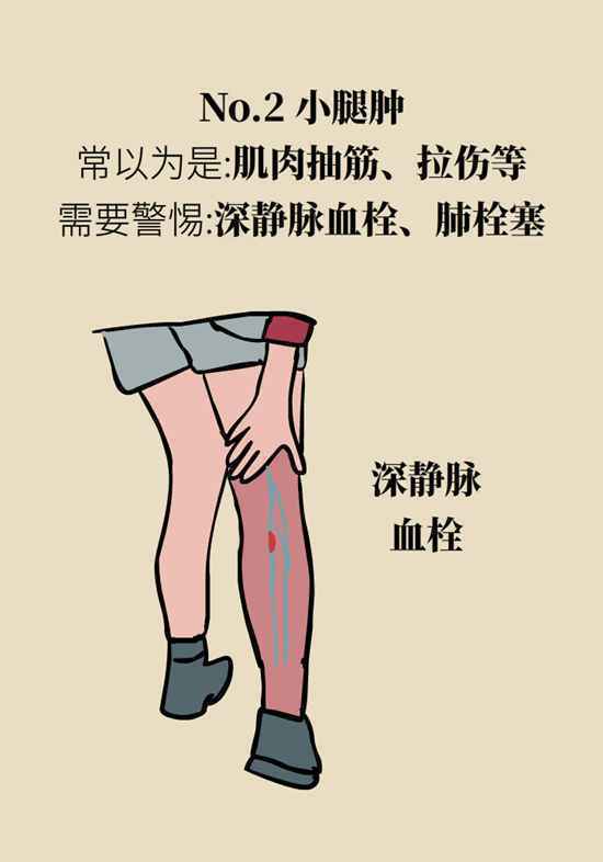 胃疼、腿疼、肩膀疼……常见症状下潜伏着哪些