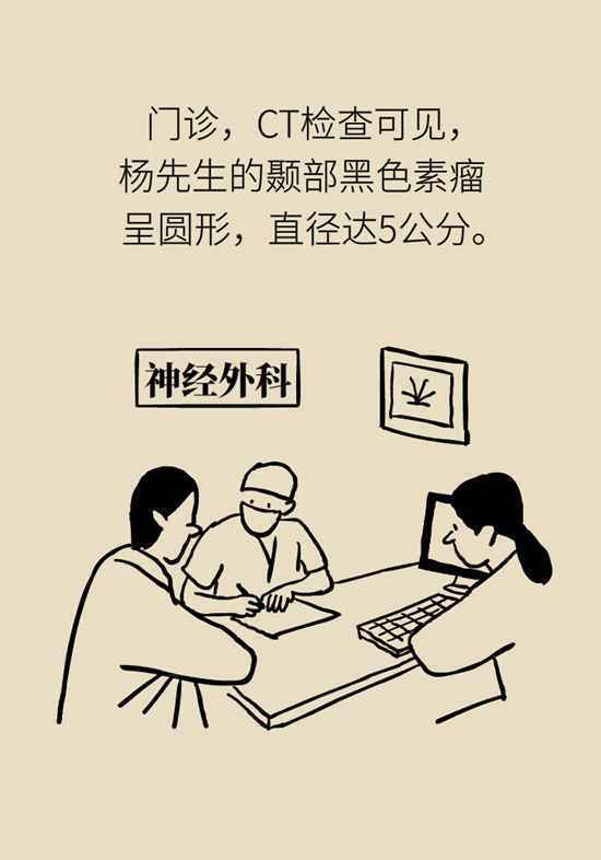 黑痣长进脑里变成瘤！痣的三个变化要警惕