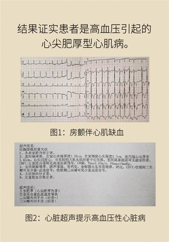 男子患高血压18年没有治疗！小心心肌损害