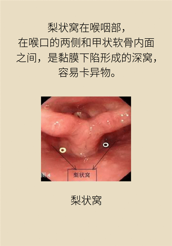 厉害了！胃镜不仅防胃癌，还能查查这个部位