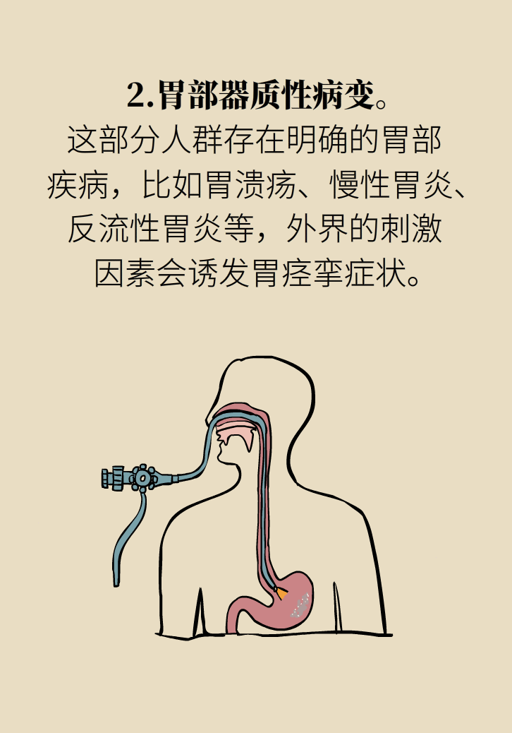 胃痉挛怎么办？两个缓解加一个根治