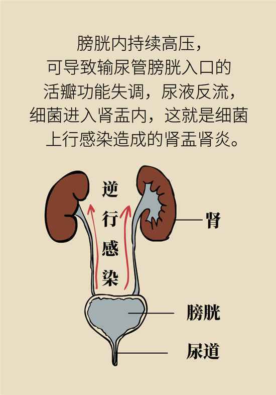 经常憋尿会得急性肾炎？保护肾脏要做到这几点