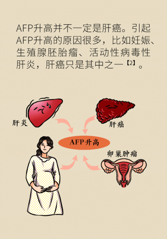 早期肝癌无症状？了解这项早检技术很重要