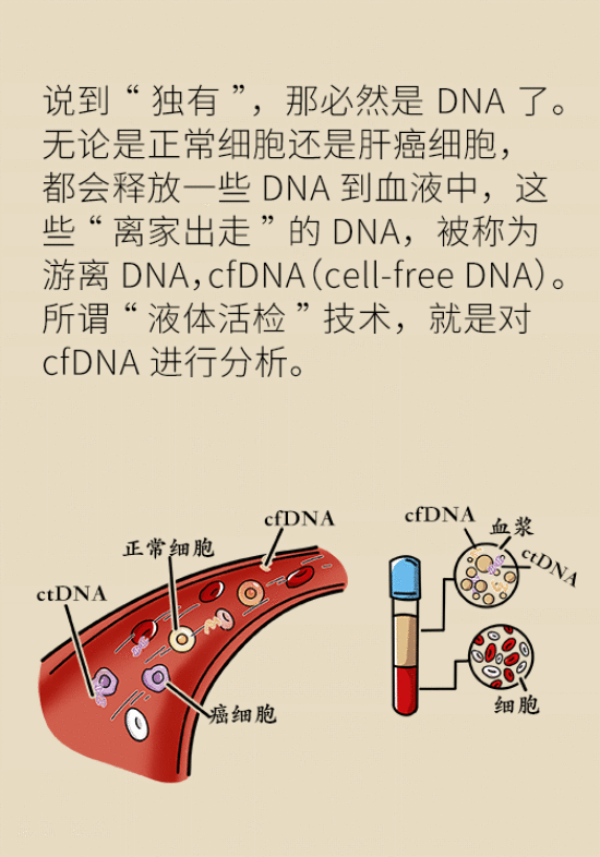 早期肝癌无症状？了解这项早检技术很重要