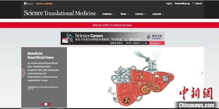 中国专家创新设计出新型生物人工肝支持系统