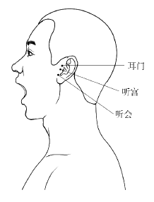 治疗耳鸣只需擦一擦耳前的3个穴位