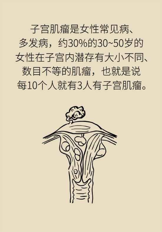 得了子宫肌瘤一定要治吗？女性朋友要注意这几