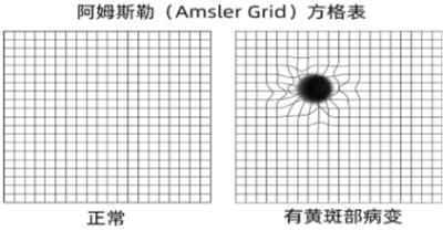 102岁老人突然眼盲后重获光明 看清人脸时连称活着有劲了