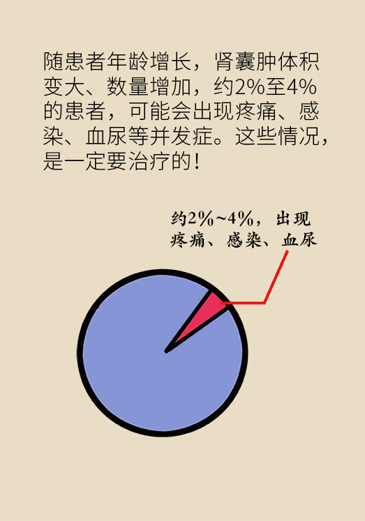 患有单纯性肾囊肿不要慌 要不要切看情况