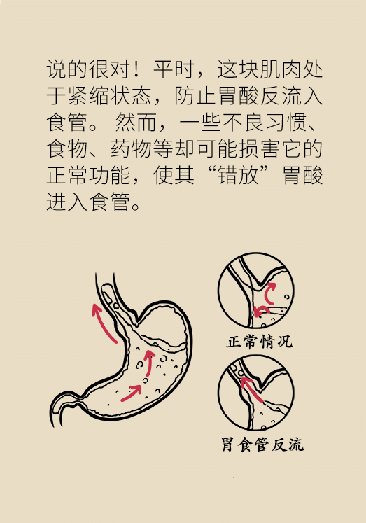 总是反酸、烧心怎么办？