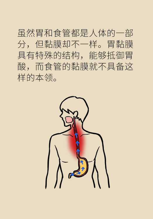 总是反酸、烧心怎么办？