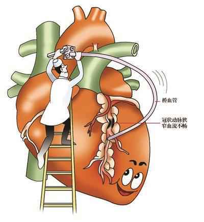 手臂发麻没在意 谁料几小时后倒地不起