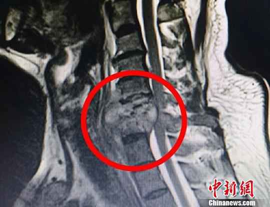 常州医生利用MR技术做手术 冯凯 摄