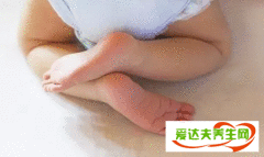 宝宝肛瘘症状有哪些 宝宝肛周囊肿的几个发展期