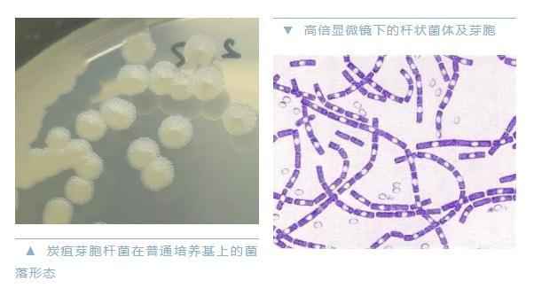 图片来源：中国疾控中心官方微信截图